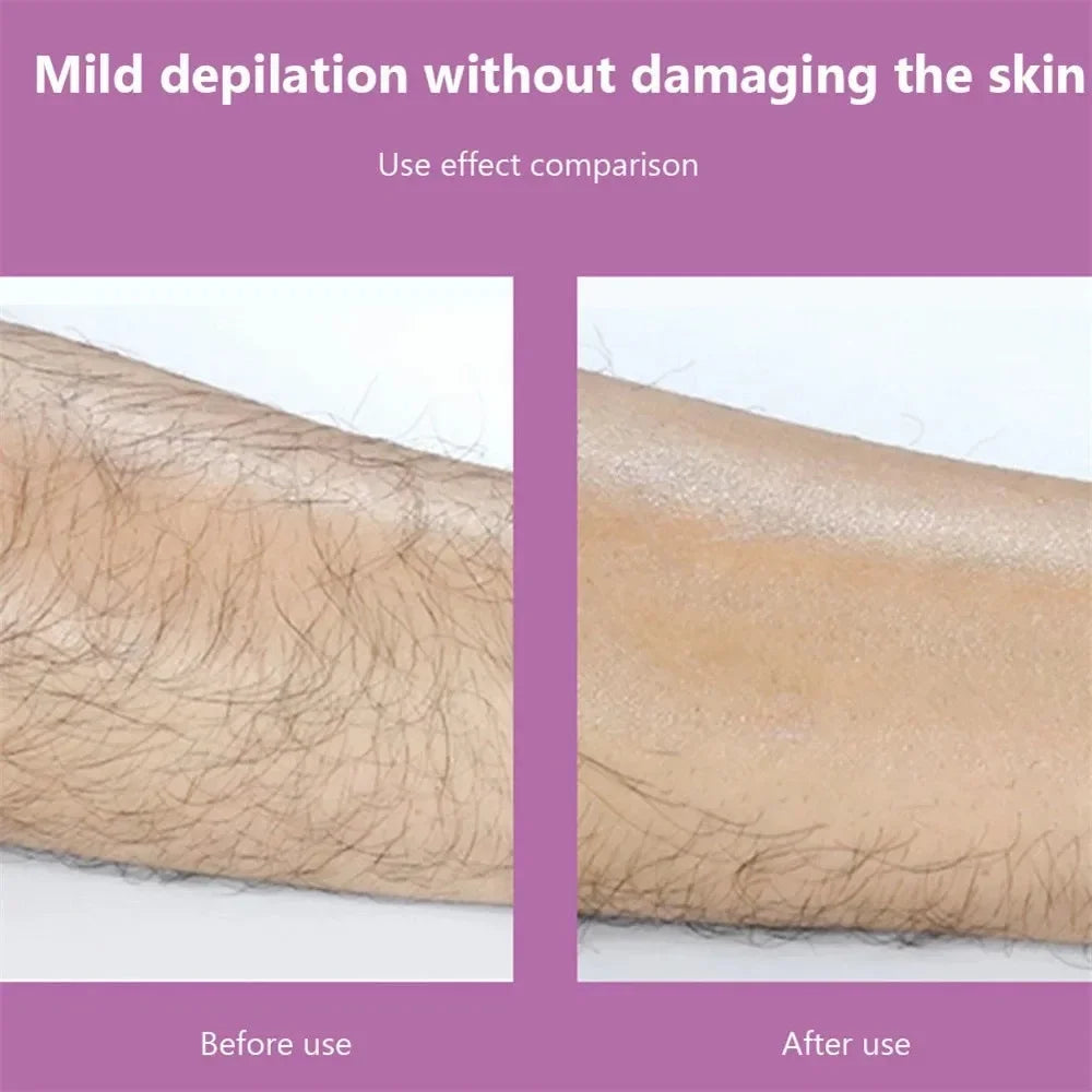 Physical Hair Removal Epilator